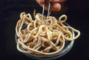 Welche Parasiten können im menschlichen Körper leben
