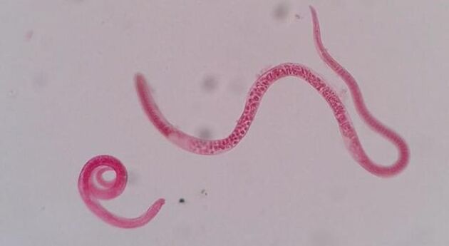 Wie sehen Trichinen aus