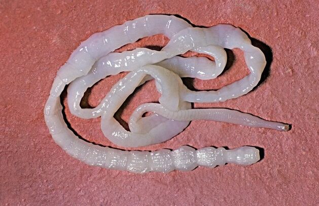 Wie sieht ein Bullenbandwurm aus